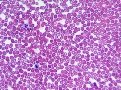 Фото клетки крови под микроскопом – Статьи на сайте Четыре глаза